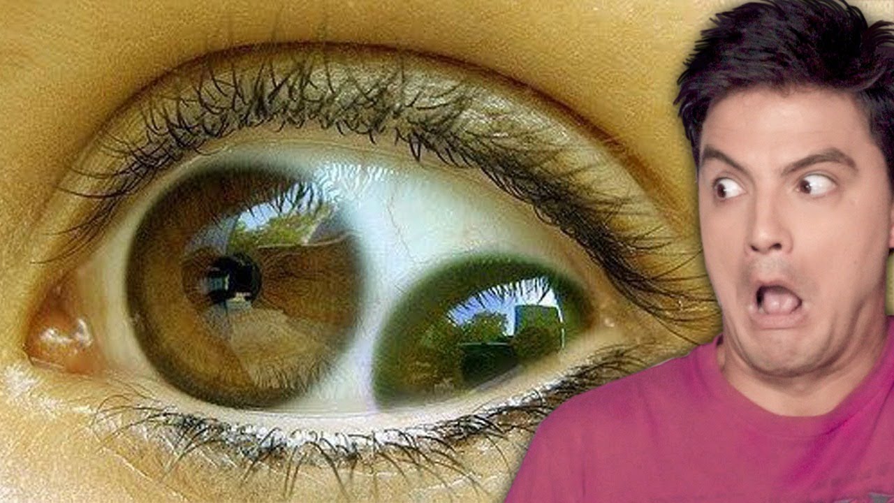 MUTAÇÕES RARAS EM SERES HUMANOS! [+10]