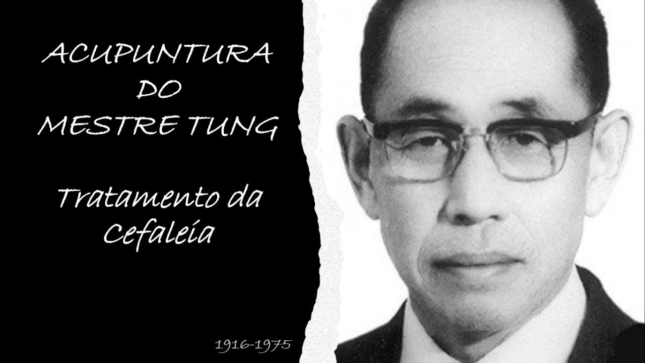 LIVE ACUPUNTURA TUNG - TRATAMENTO DA CEFALEIA