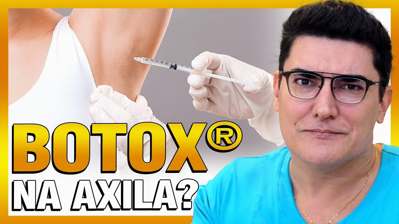 Botox® na Axila? | Toxina botulínica para Hiperidrose Axilar