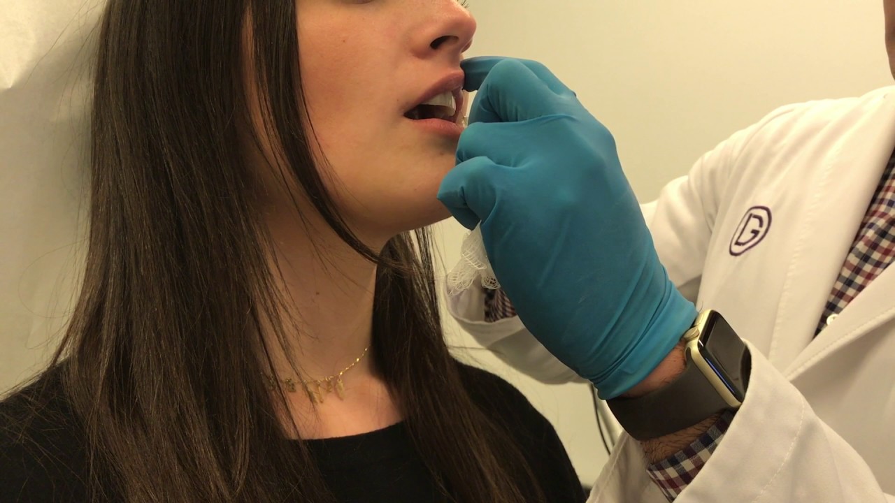 Juvederm Volbella Lip Injection