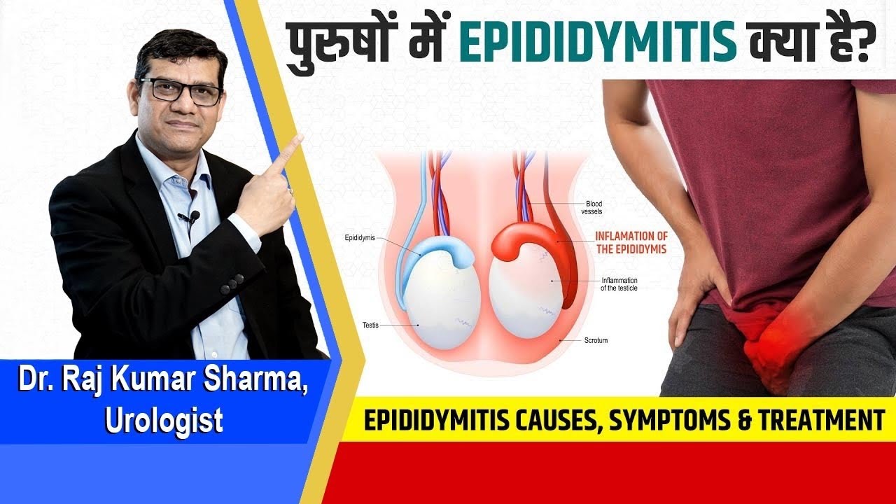 Epididymitis, Epididymis, Epididymal Cyst - can cause testes Pain, swelling and infertility 