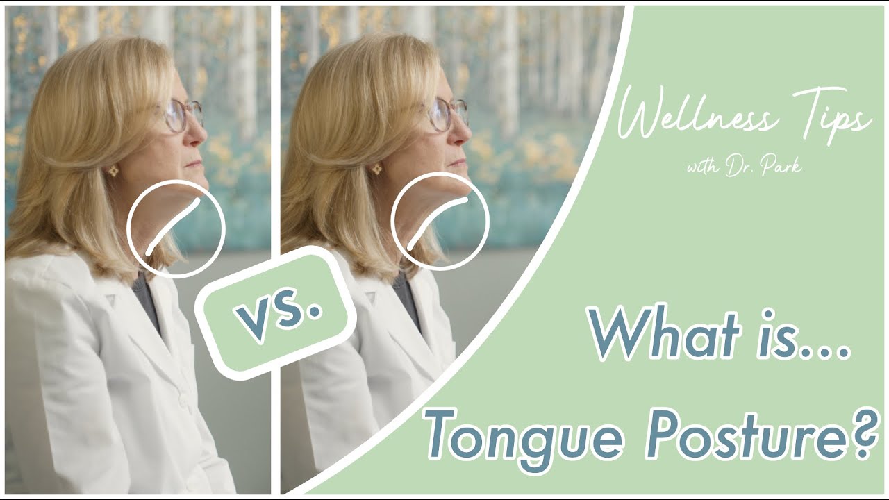 What is Proper Tongue Posture?