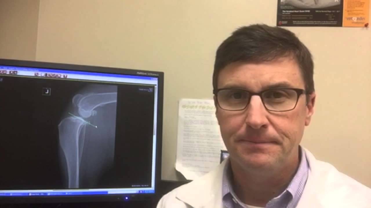 Canine ACL Repair by CBLO