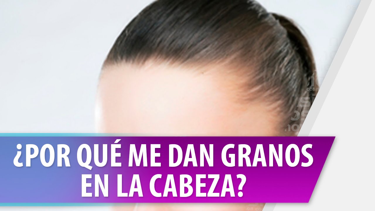 Granos en la cabeza