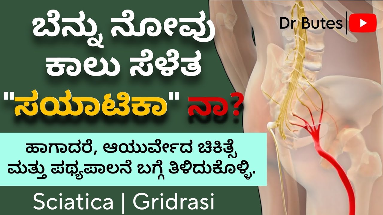 Sciatica Treatment - How to cure SCIATICA NERVE PAIN In kannada | ಬೆನ್ನು ನೋವು ಮತ್ತು ಕಾಲು ಸೆಳೆತ