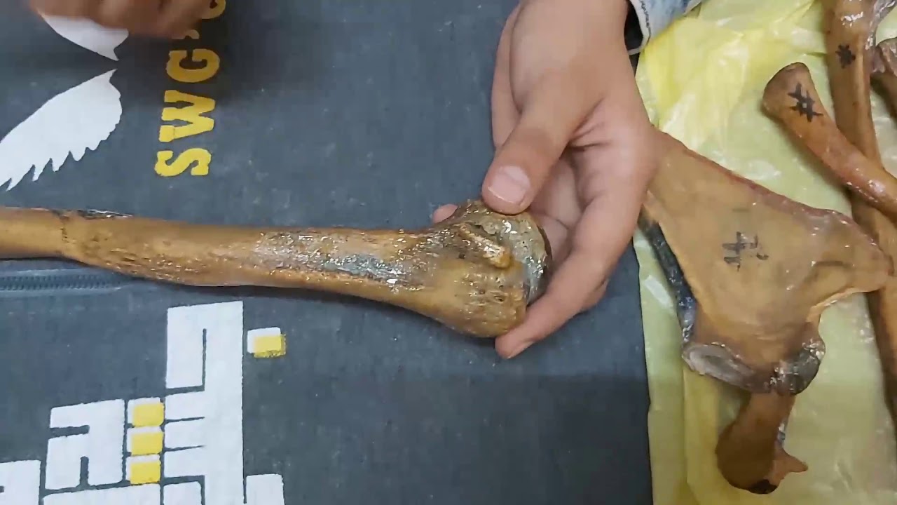Upper Limb Practical (particular features) Anatomy