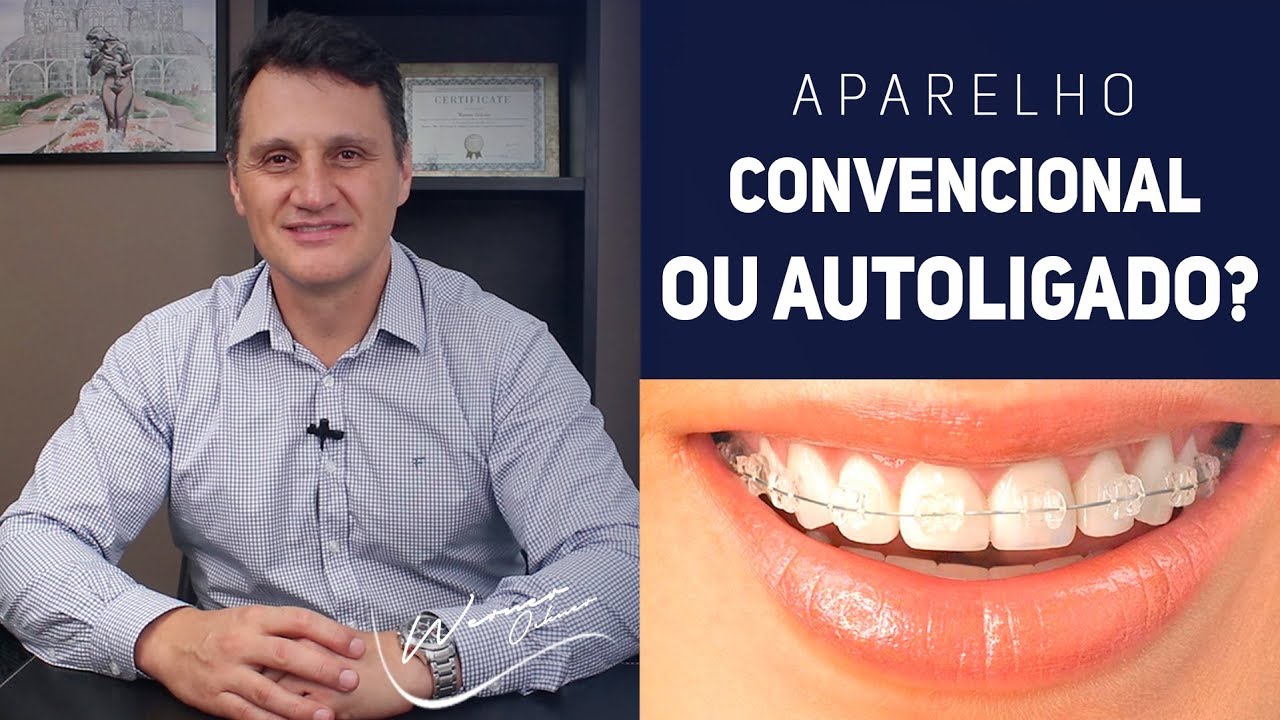 APARELHO AUTOLIGADO / AUTOLIGÁVEL X CONVENCIONAL | WERNER OCKNER