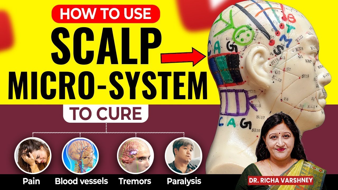 Acupressure Scalp Therapy - Cure Pain, Paralysis, Tremors, Vascular Disorders [Hindi]