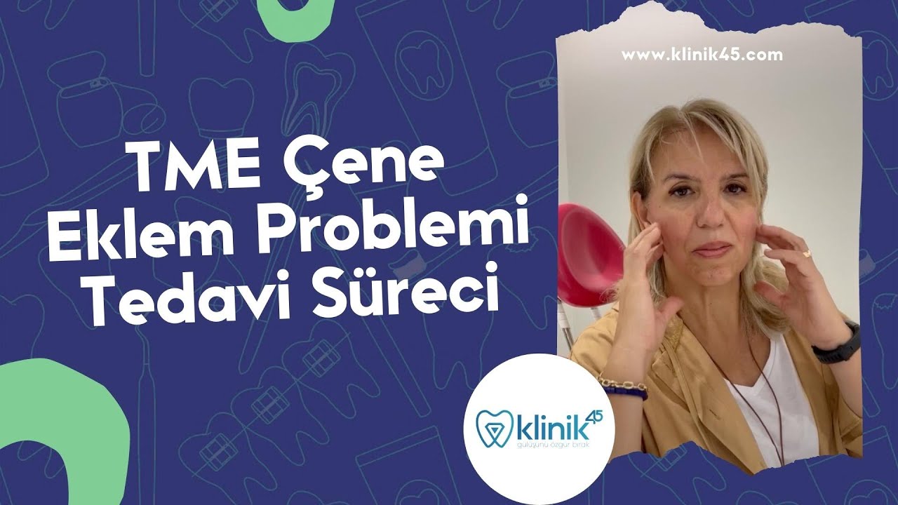 Çene Eklem Ağrısı ve Hareket Kısıtlılığı Tedavi süreci 💙 @klinik45 Manisa Dr. Gizem Altuğ Türkyılmaz