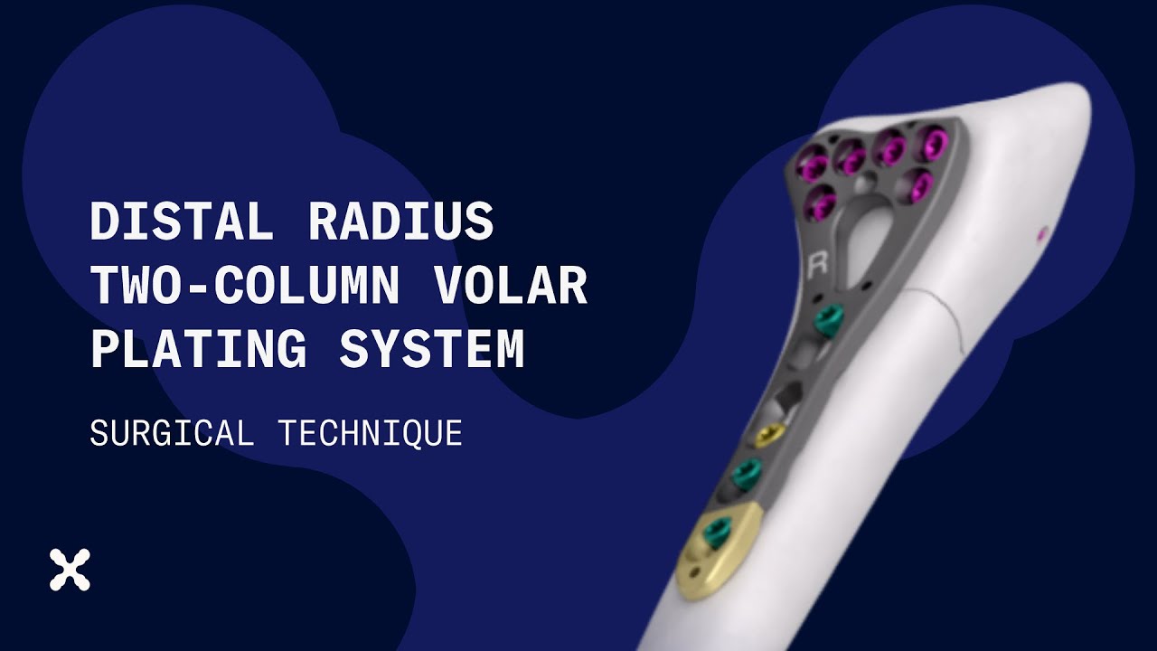 Surgical Technique: Two-Column Volar Distal Radius Plate | 2.4 mm Variable Angle System