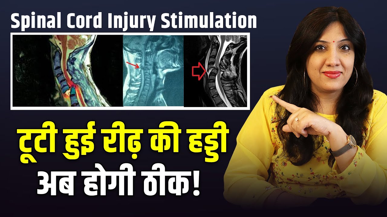 Spinal Cord Stimulation & Recovery Options | Spinal Injury Treatment Explained by Dr. Neha Arora
