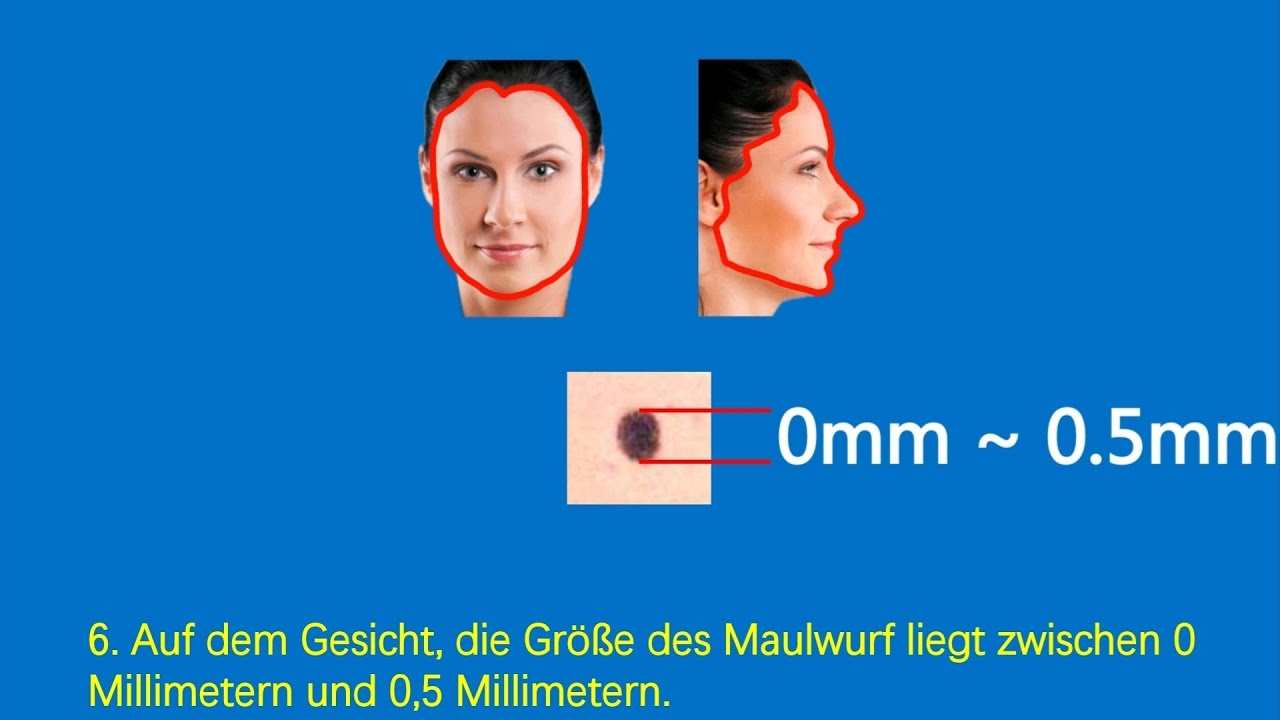 Auf dem Gesicht, die Gr&ouml;&szlig;e des Maulwurf liegt zwischen 0 Millimetern und 0,5 Millimetern.