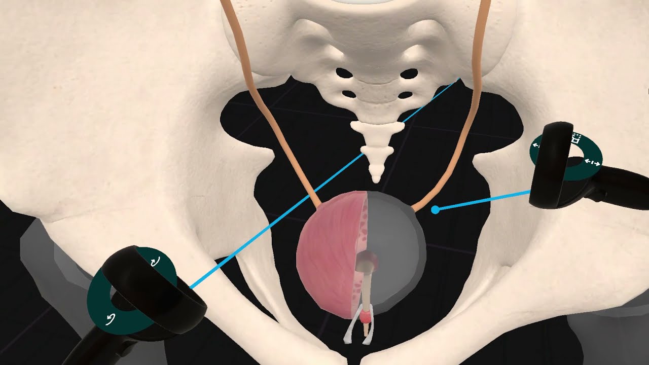 Anatomía de los uréteres