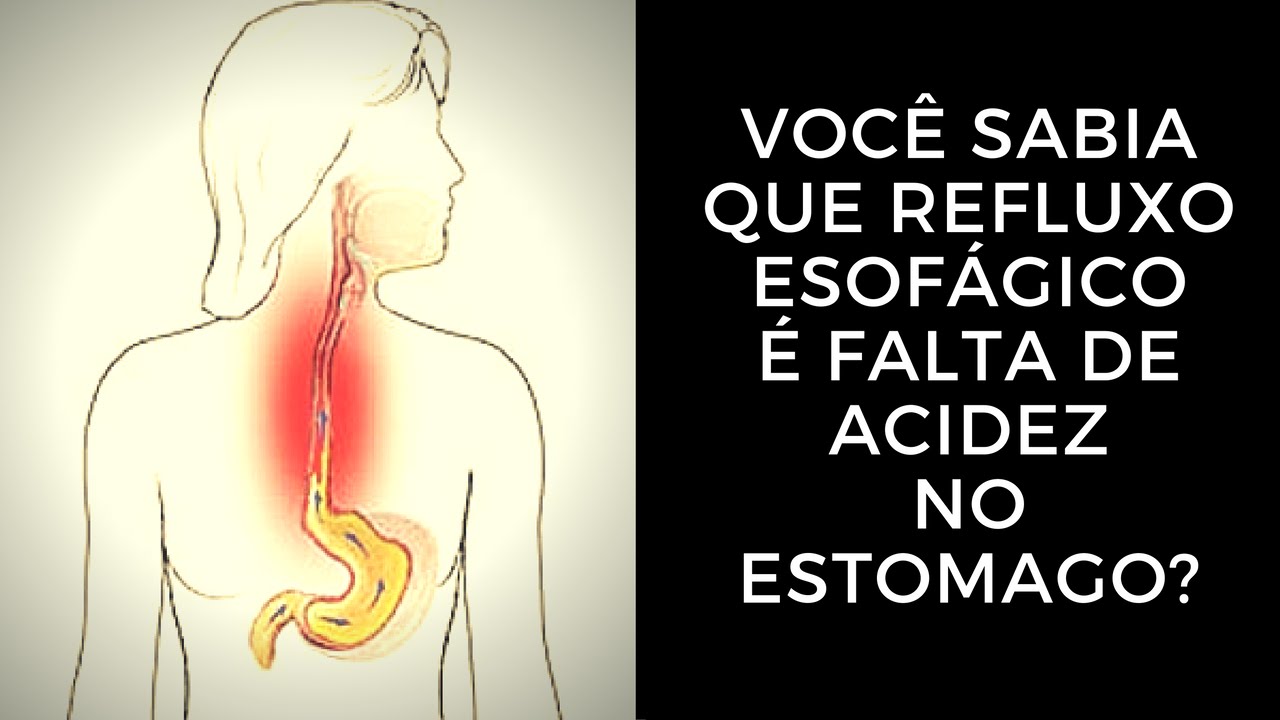 Você Sabia que Refluxo Esofágico é Falta de Acidez no Estômago?