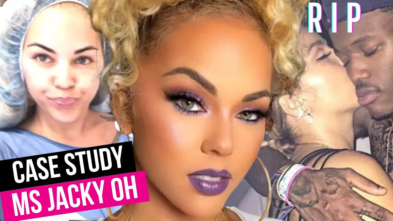 The TRUTH About Ms. Jacky Oh's Passing in Miami, Non-Board Certified Plastic Surgeon & DC Young Fly