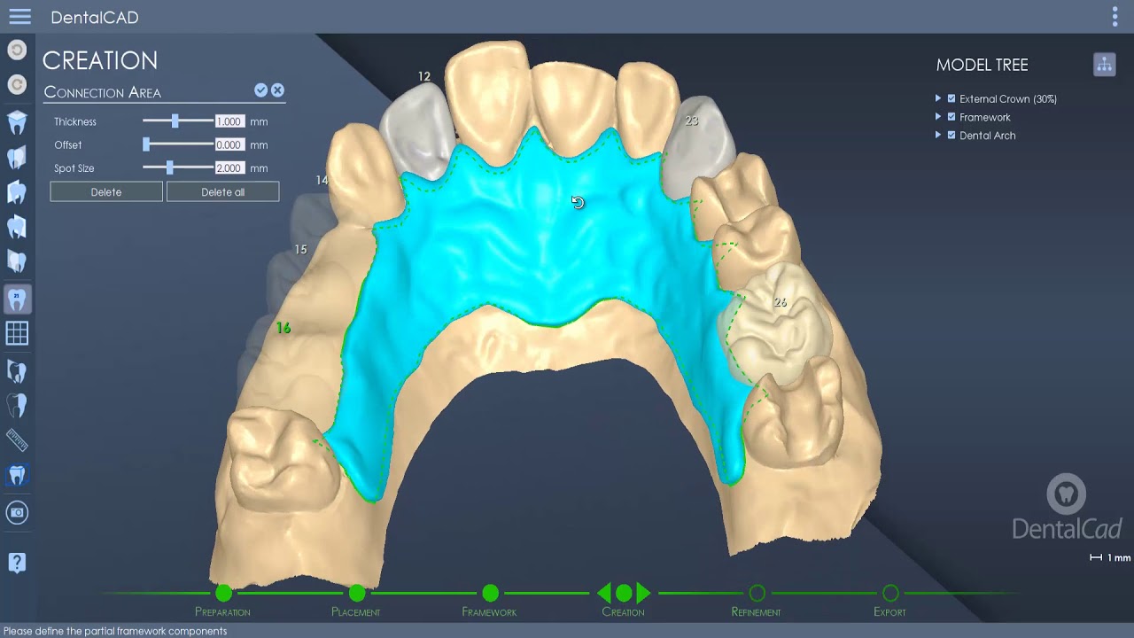 DentalCad 2019 - Partial Framework