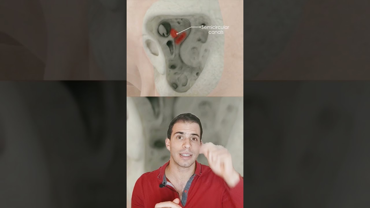cirug&iacute;a del colesteatoma: Mastoidectom&iacute;a #shorts #cirugia #medicina
