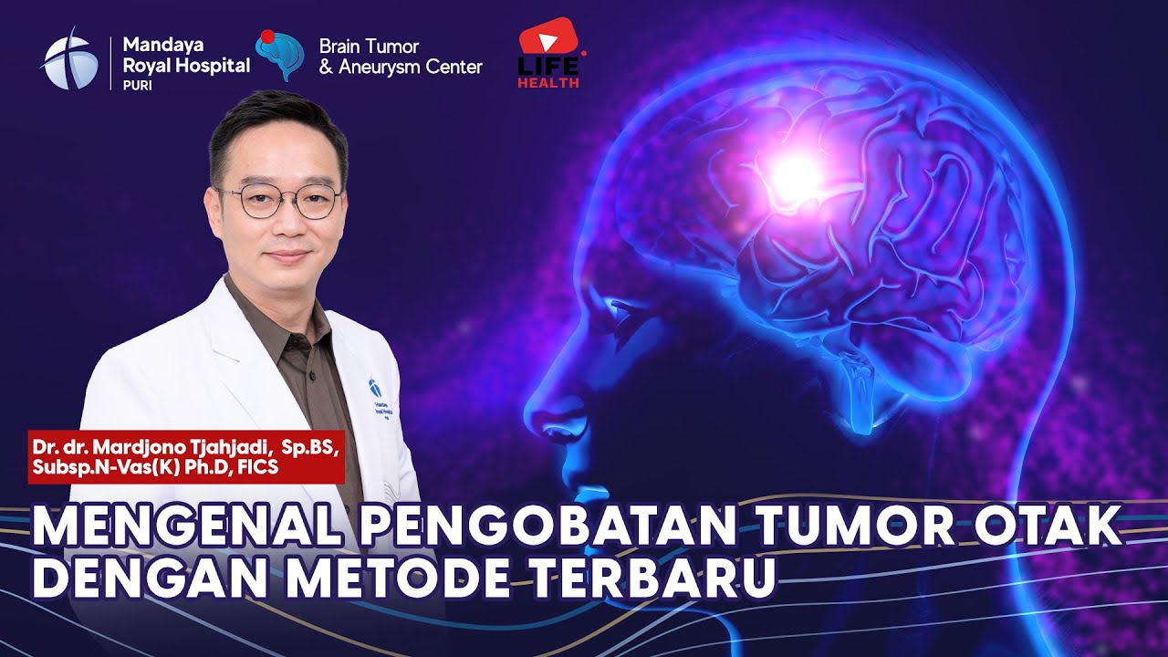Penanganan Tumor Otak Metode Terbaru Melalui Hidung Tanpa Bedah Kepala oleh Dr. Joy Sp.BS