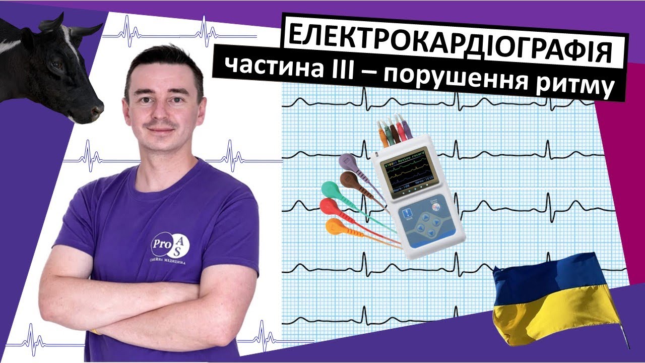 ЕКГ для первинної медичної допомоги. Частина 3. Порушення ритму #ЕКГ #електрокардіографія #аритмія