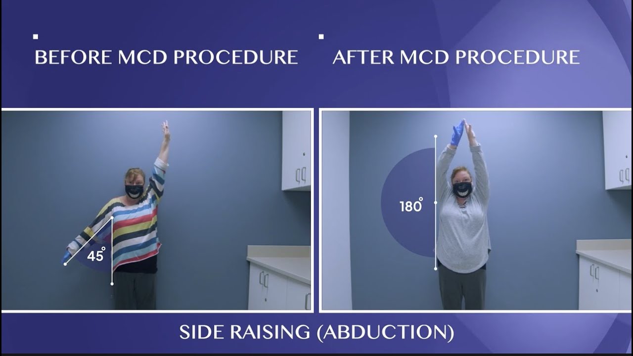 Cured Months Of Frozen Shoulder Pain!