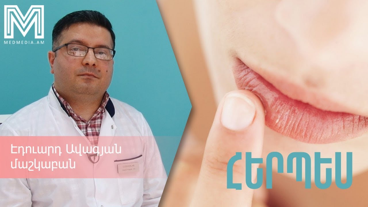 «Երեք խորհուրդ բժշկից»․  Հերպես