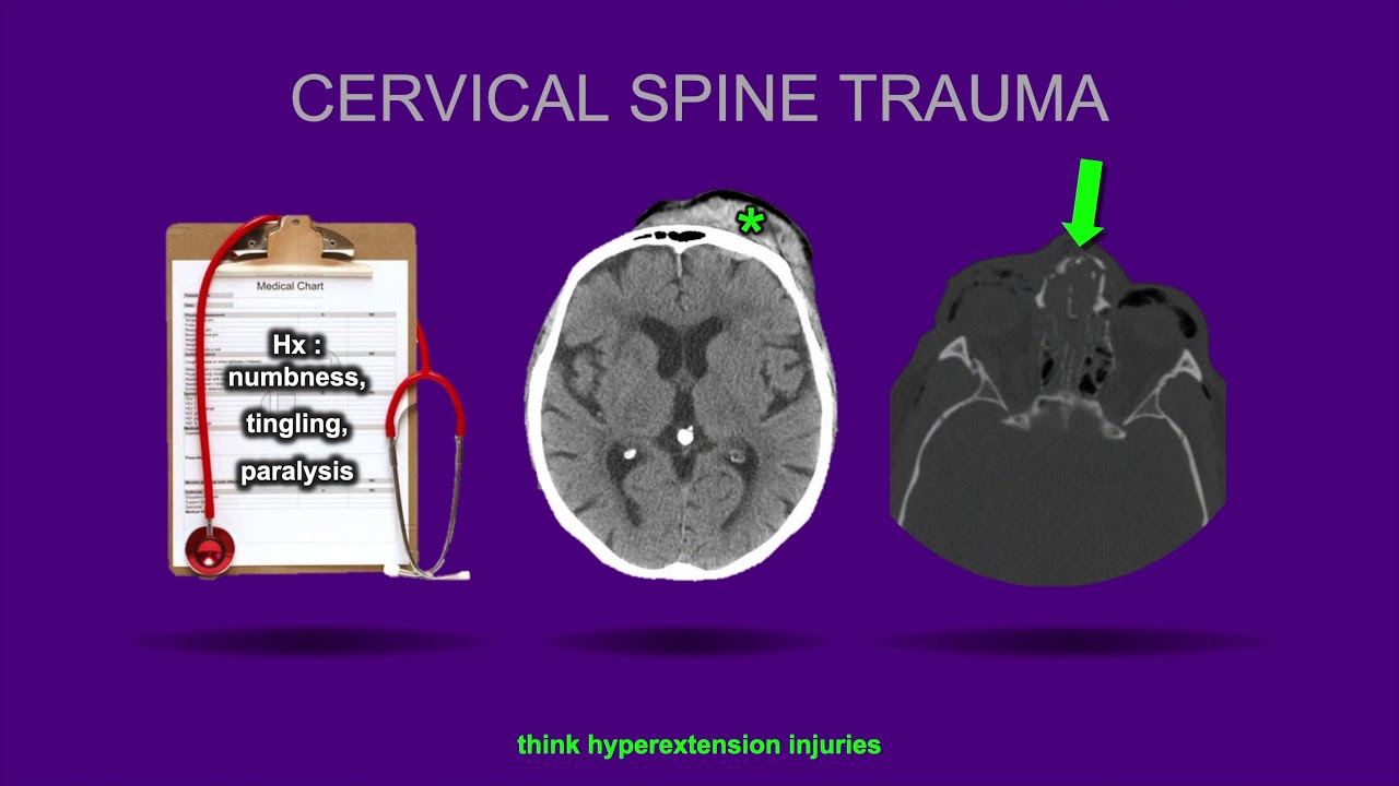 Spine Imaging - ABOS Orthopedic Surgery Board Exam Review