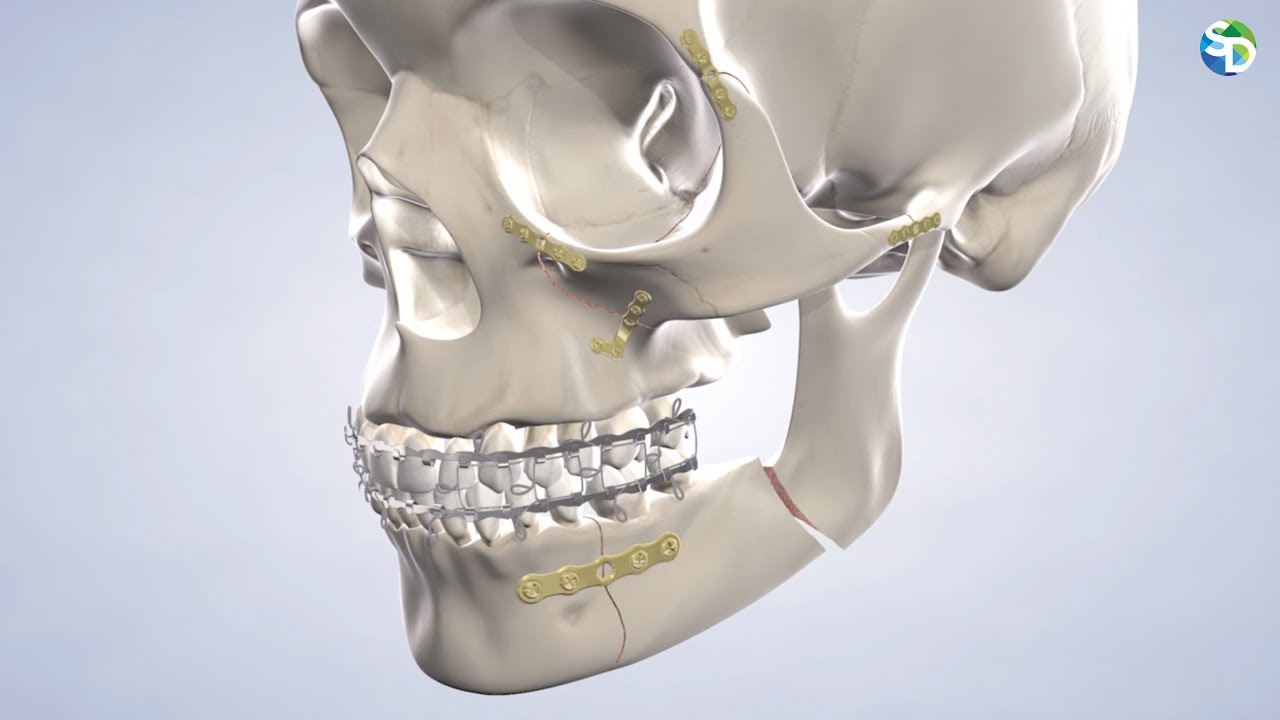 Treating Traumatic Facial Injuries in San Diego, CA