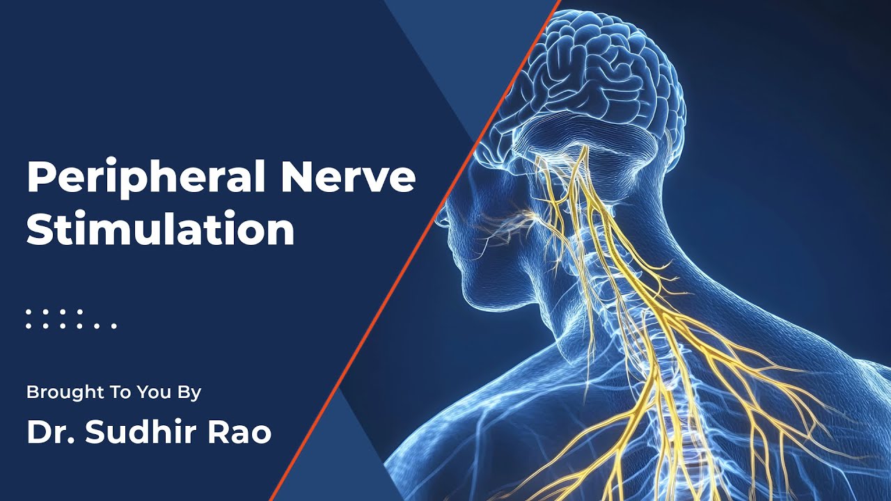 Peripheral Nerve Stimulation | Pain and Spine Specialists