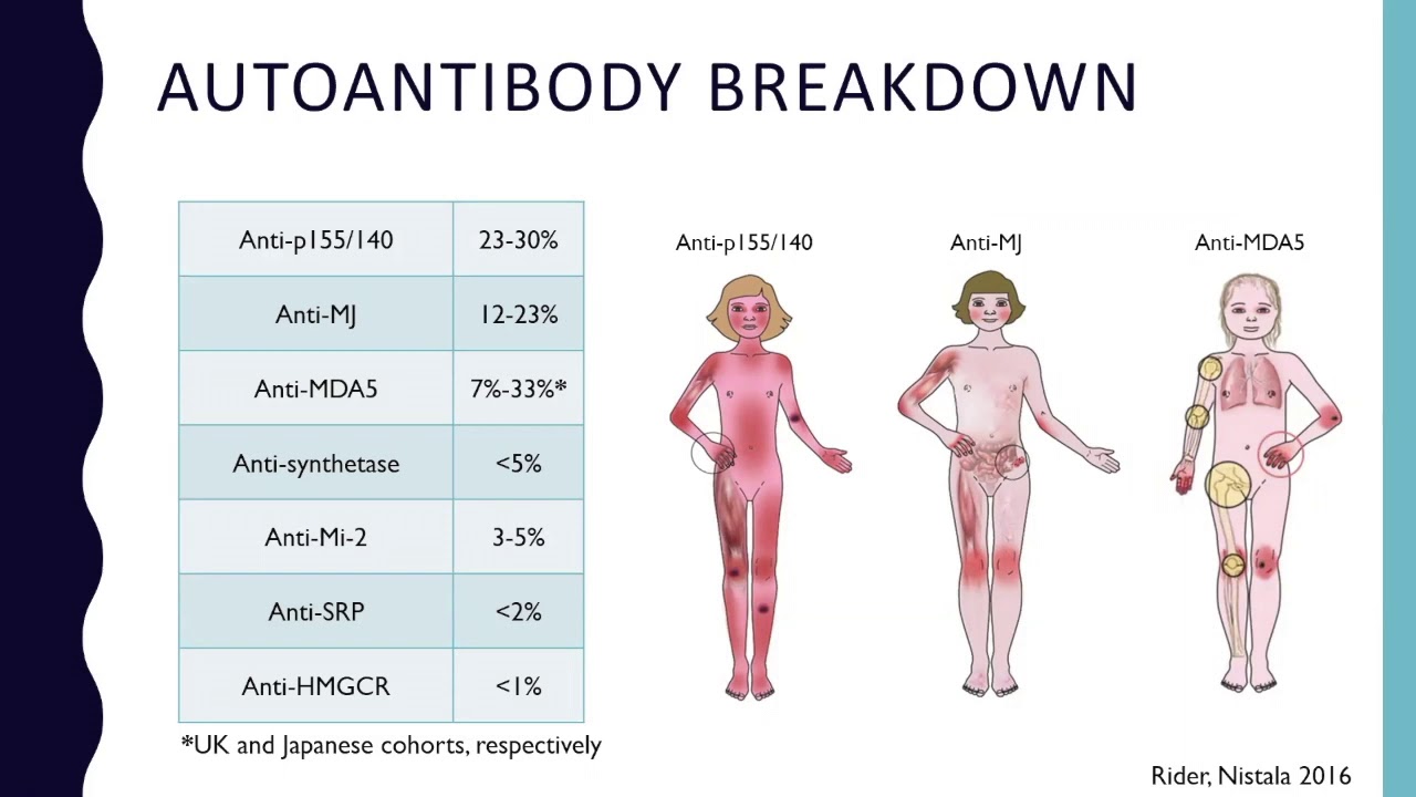Autoantibodies in Juvenile Myositis