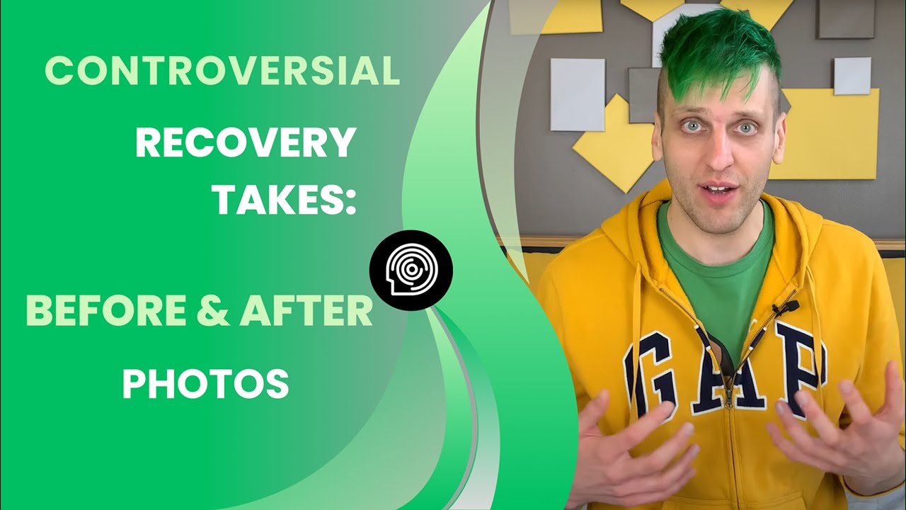 Controversial Recovery Takes: Before & After Photos