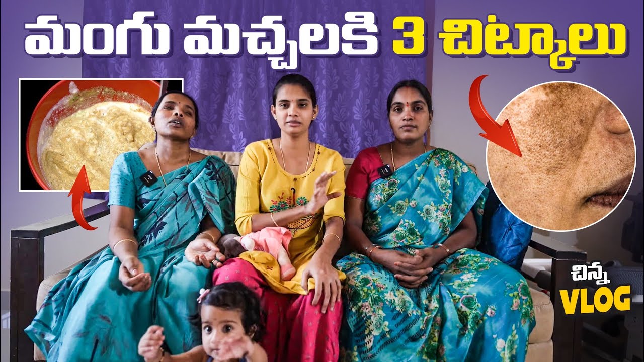3 Tips For Pigmentation | మంగు మచ్చలకి 3 చిట్కాలు | Kavitha Naga Vlogs | Adi Reddy Bigg Boss Telugu