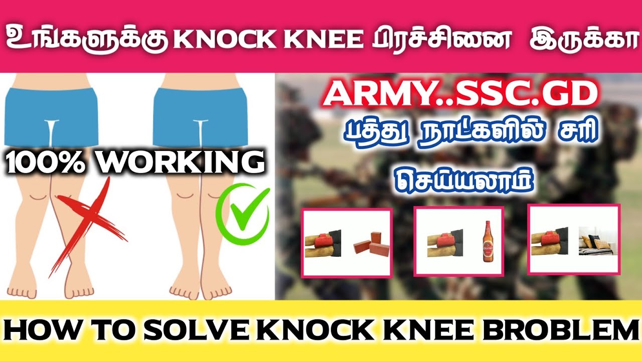 How to solve Knock Knee broblem in tamil | how to solve Knock Knee broblem for army | pravin army