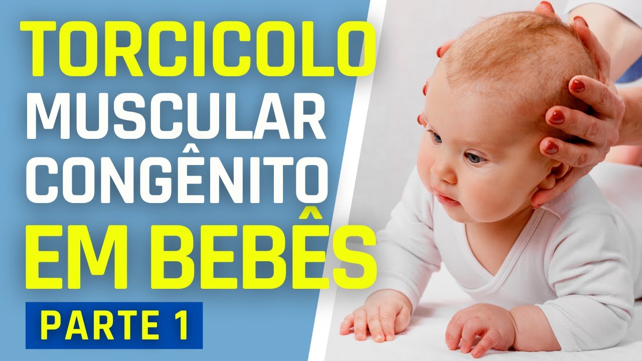 TORCICOLO MUSCULAR CONGÊNITO EM BEBÊS | PARTE 1