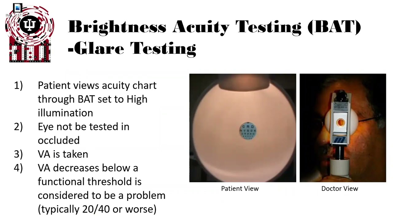 Brightness Acuity Testing and Glare