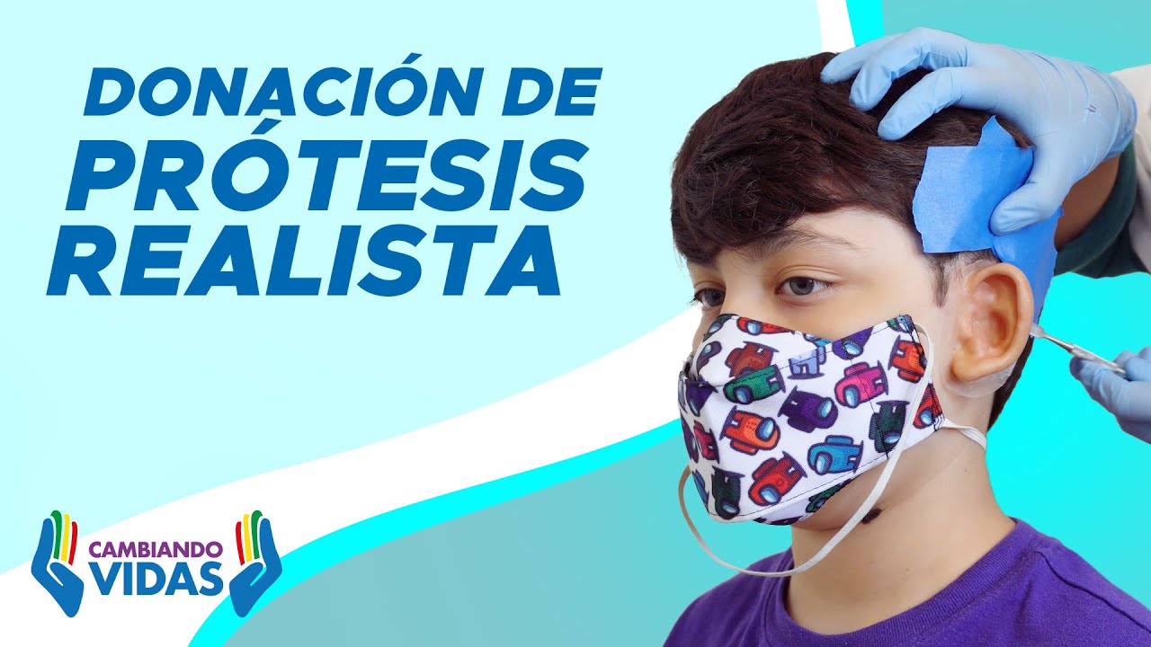 Donación de Prótesis Realista de Oreja – Campaña Cambiando Vidas – ANPS
