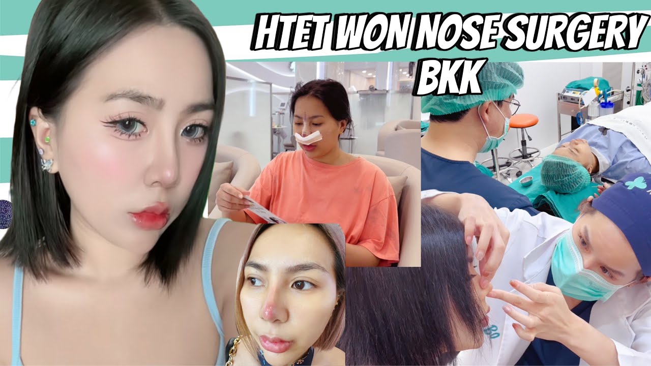 Htet Won’s Nose Surgery at BKK Vlog 🇹🇭