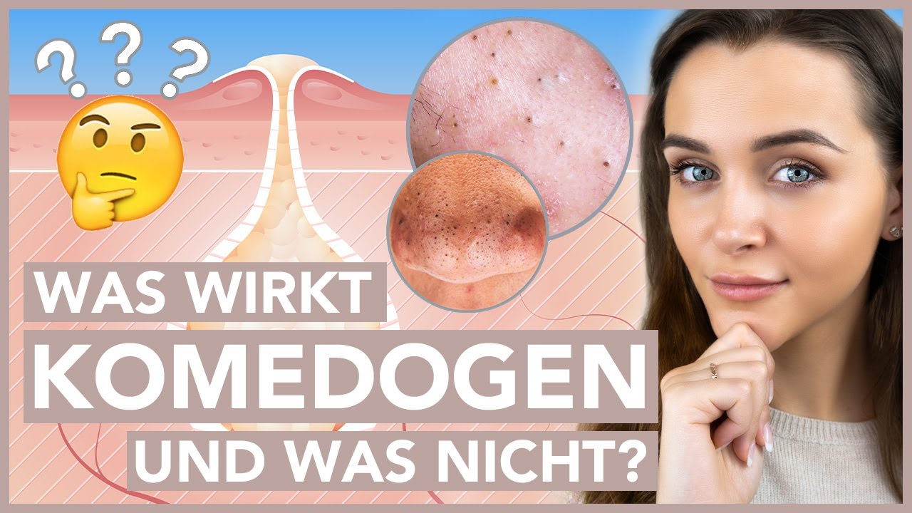 KOMEDOGEN? – Was ist komedogene Gesichtspflege?