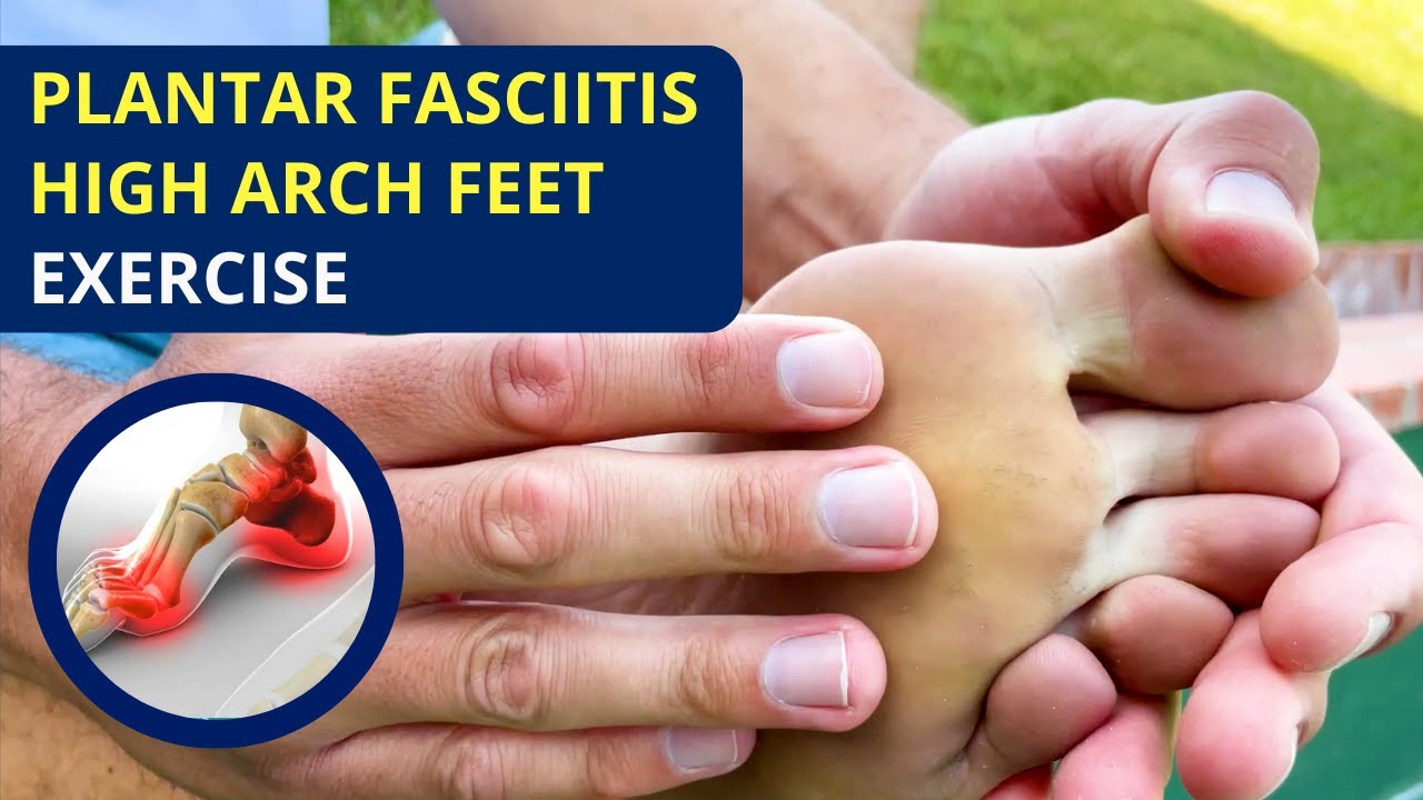 Fix Plantar Fasciitis and Pain in High Arch Feet Exercises and Routine 🦶🏻