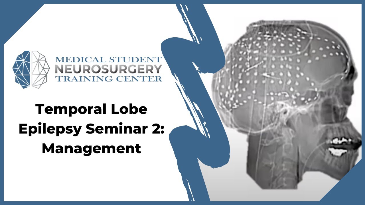 Temporal Lobe Epilepsy Seminar 2: Management