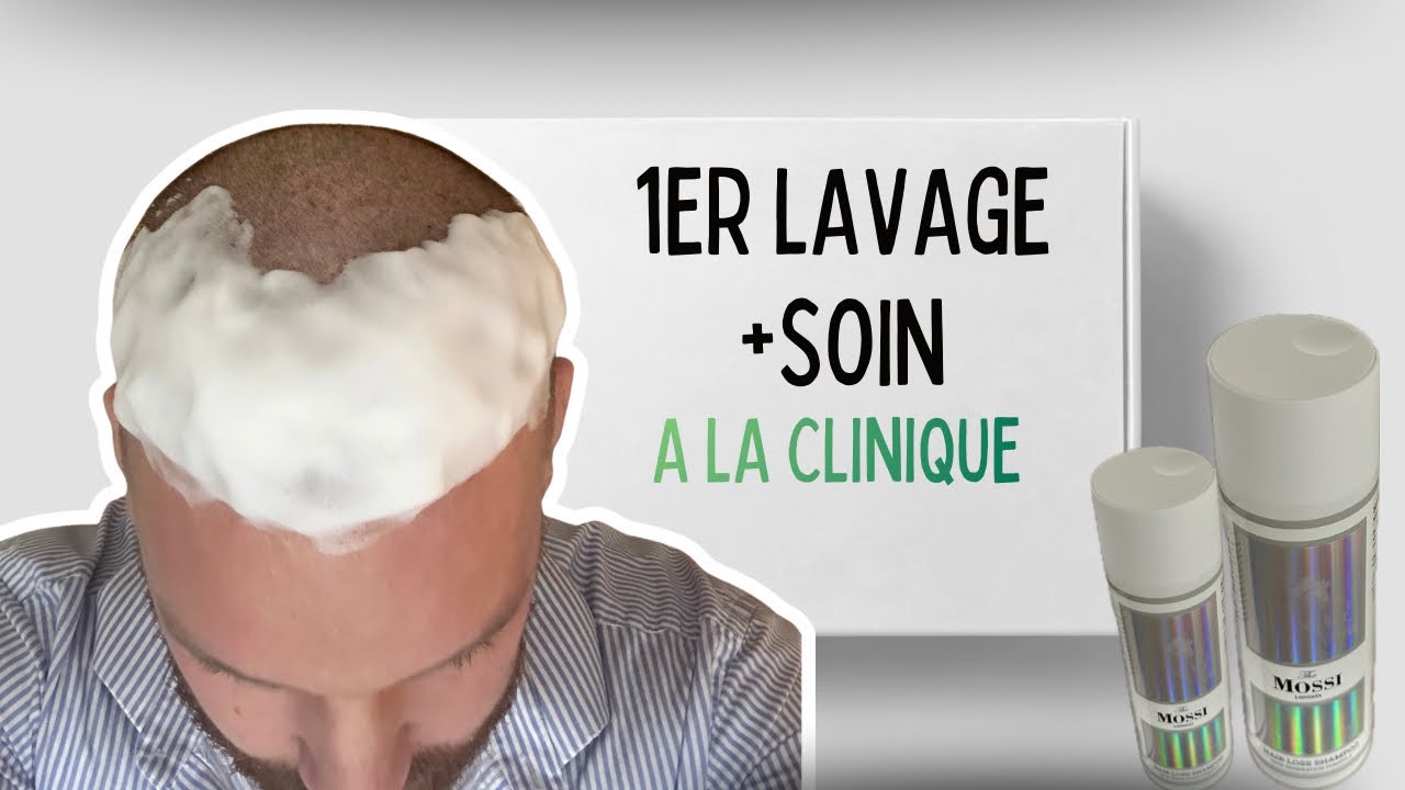 🔵 GREFFE DE CHEVEUX | 1er LAVAGE à la clinique + SEUL 