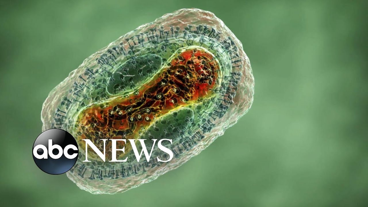 3 children in Georgia test positive for monkeypox