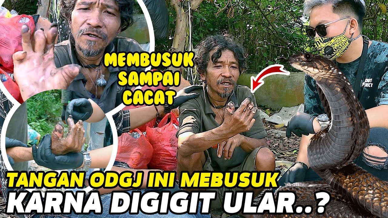 MERINDING !! JARI BAPAK INI PUTUS KARNA DIGIGIT ULAR KOBRA ??  |Ft DIMAN KHAN TV