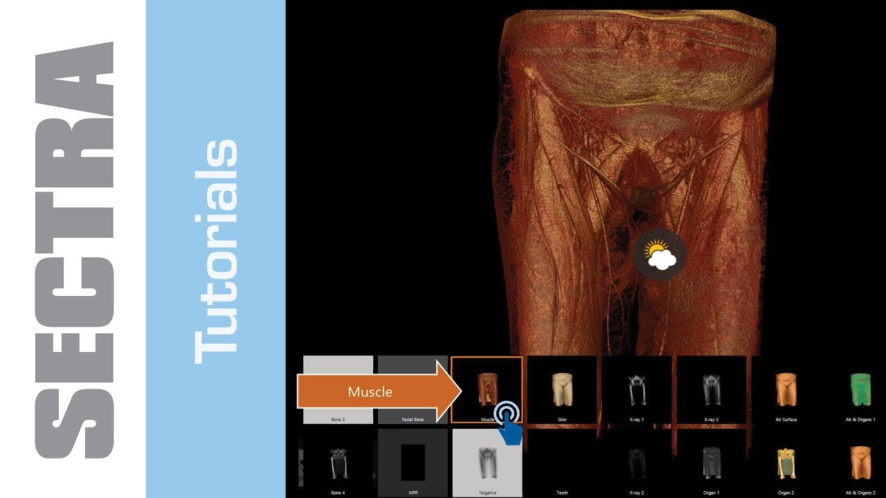Tutorial Sectra IDS7 Touch - Presets and Global Illumination