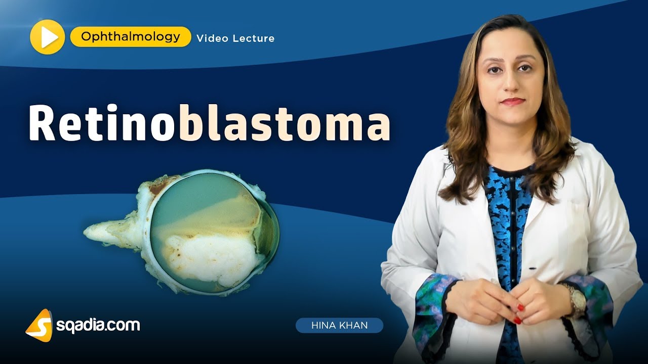 Retinoblastoma | Ophthalmology Video Lecture | Medical Student V-Learning | sqadia.com