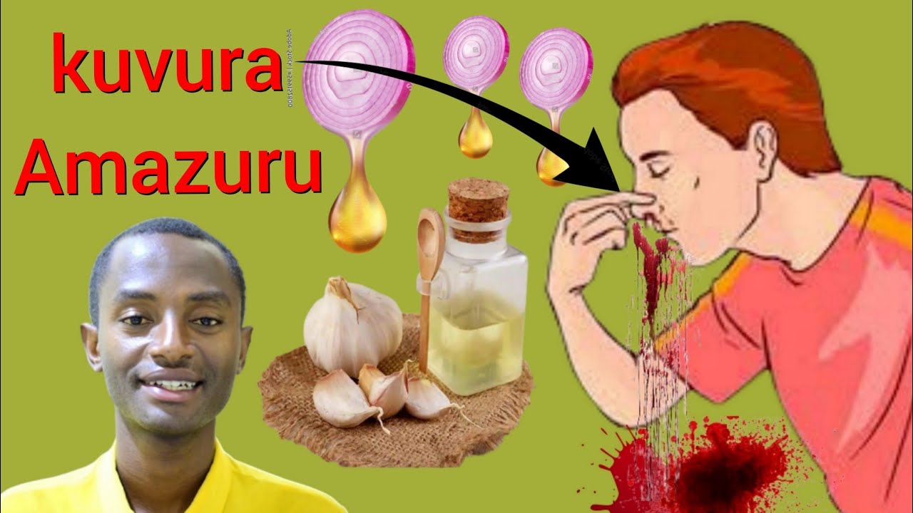 Ibimyira, ibicurane, imyuna, umuriro mwinshi. ibihaha. umuhogo.  Kaziyake Benjamin