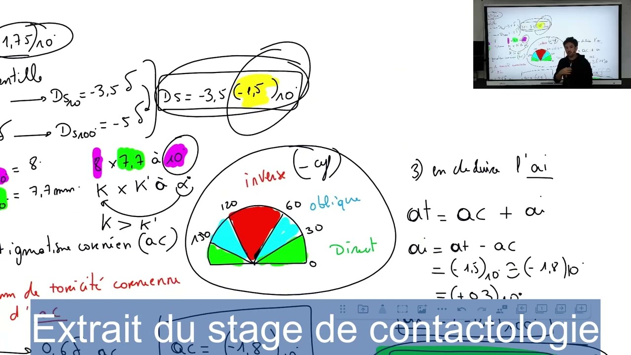 Stage de contactologie BTS OL