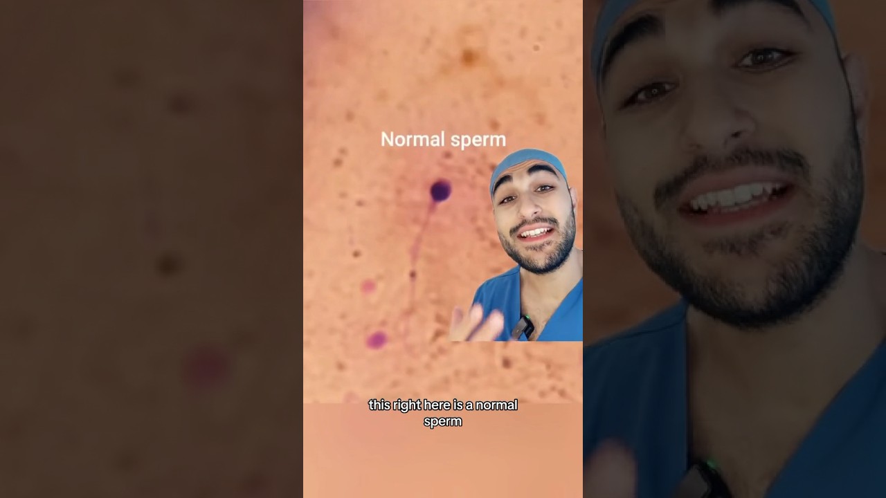 How does an abnormal SPERM look like?🤯🤯