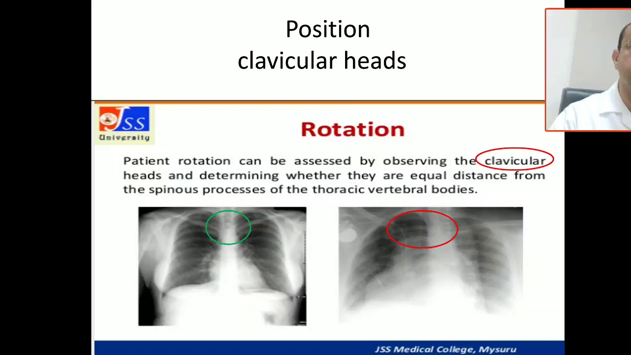 Part 2 chest X ray interpretation, quality of images