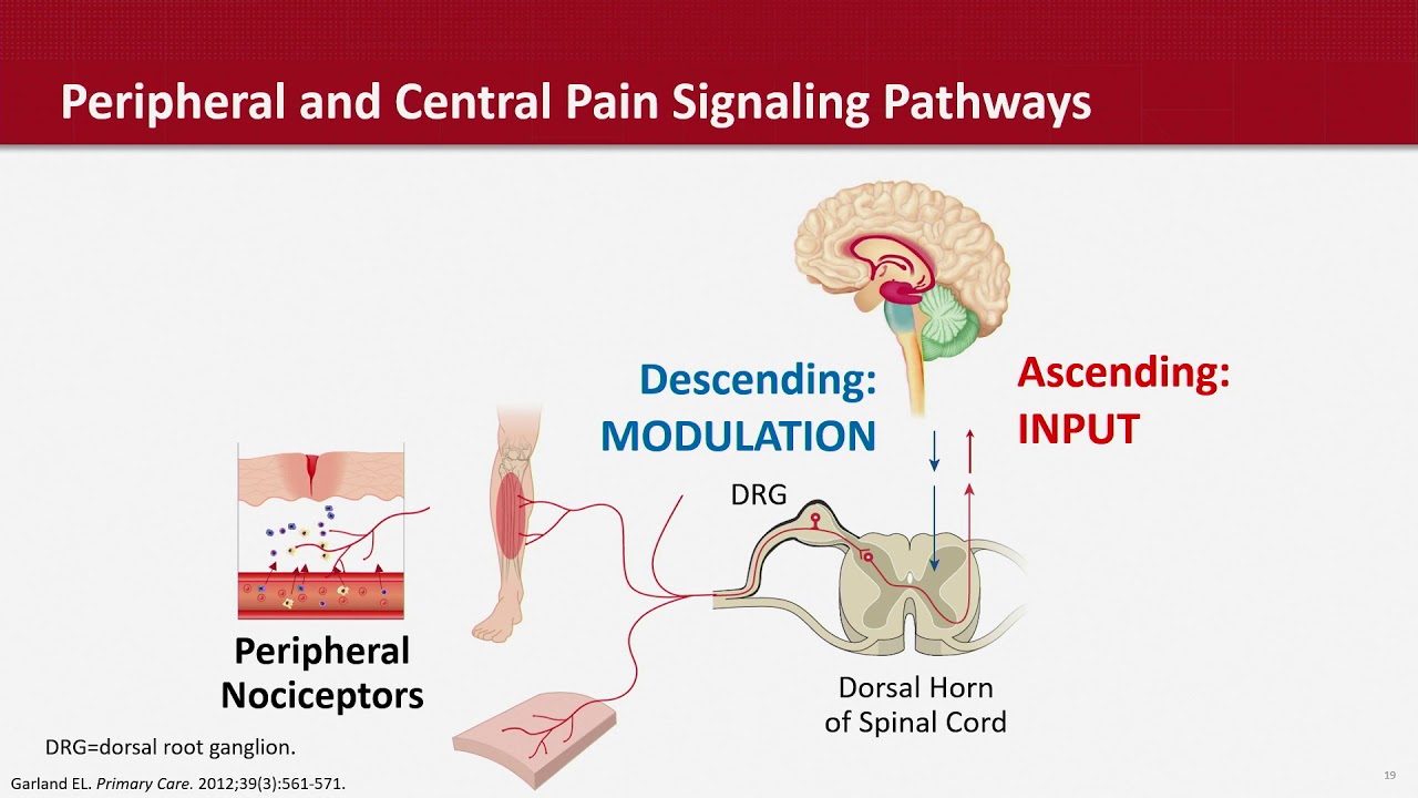 Chronic Pain: Unmet Needs, New Frontiers