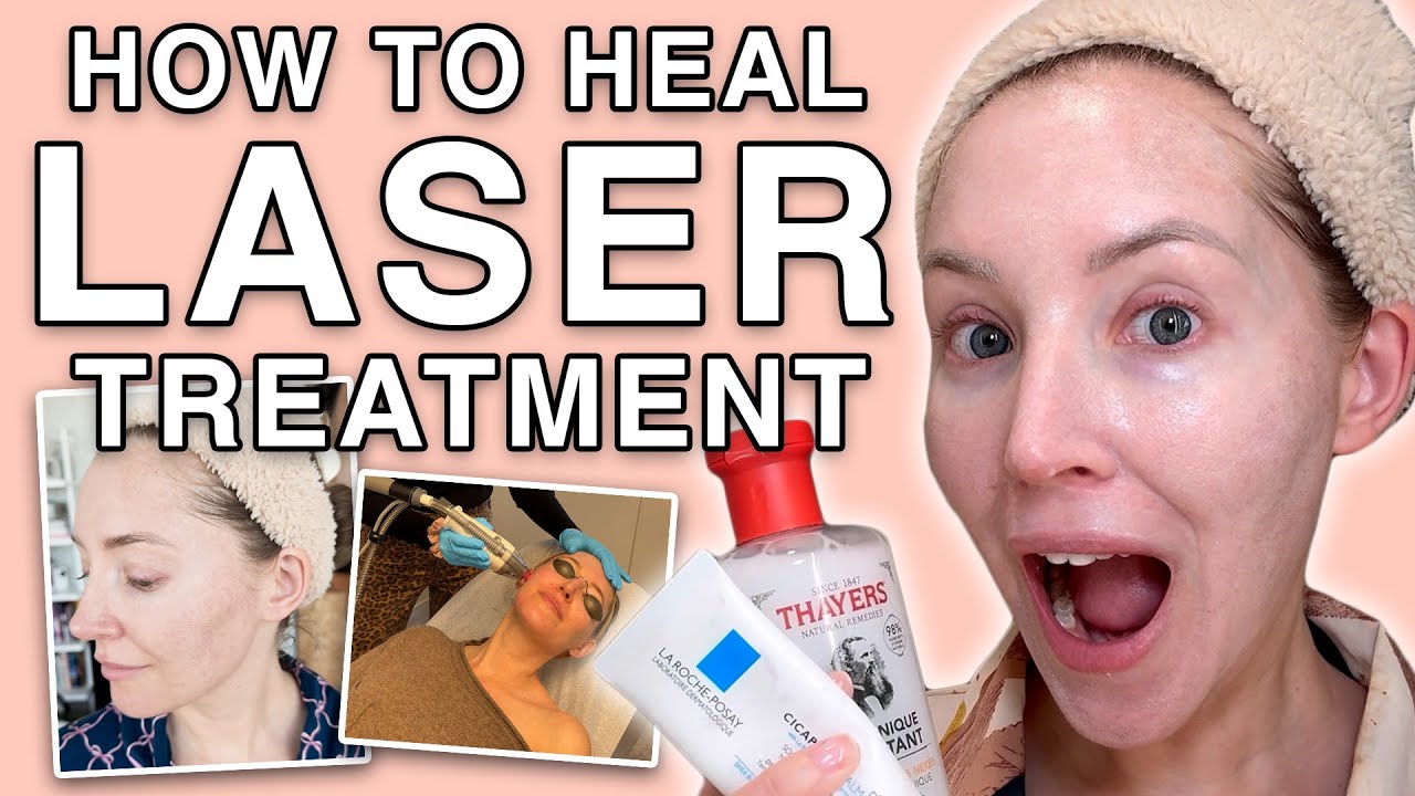Skincare Routine to Heal from Fraxel Dual